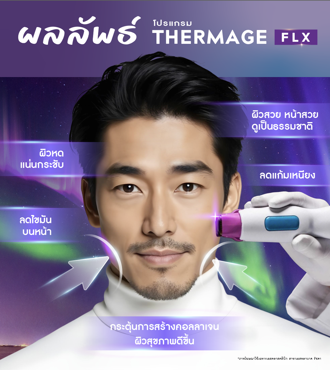 Thermage FLX 900 shots ราคา