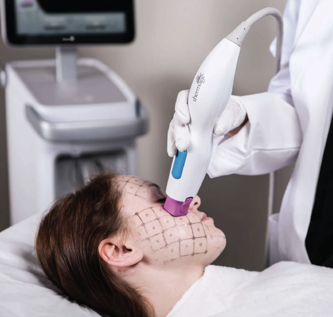 Thermage FLX 900 shots ราคา